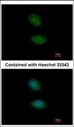 AMMECR1 Polyclonal Antibody