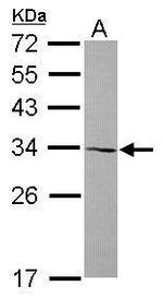 AMMECR1 Antibody in Western Blot (WB)