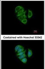 CaMKK beta Antibody in Immunocytochemistry (ICC/IF)