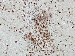 HIST1H2BD Antibody in Immunohistochemistry (Paraffin) (IHC (P))