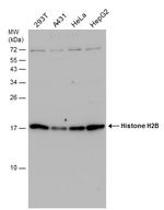 HIST1H2BD Antibody in Western Blot (WB)