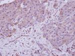 NAA15 Polyclonal Antibody