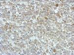 PPME1 Polyclonal Antibody