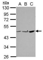 PPME1 Antibody in Western Blot (WB)