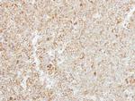 MTHFS Polyclonal Antibody