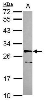 CDK10 Antibody in Western Blot (WB)