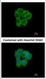NMT2 Polyclonal Antibody