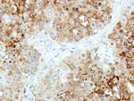 B4GALT4 Polyclonal Antibody