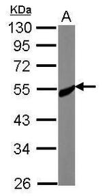 CREST Antibody in Western Blot (WB)