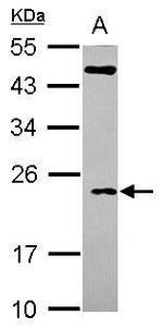 TC10 Polyclonal Antibody
