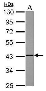 NSDHL Polyclonal Antibody