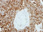 KIF20A Antibody in Immunohistochemistry (Paraffin) (IHC (P))