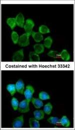 Involucrin Polyclonal Antibody
