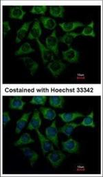LOR Polyclonal Antibody