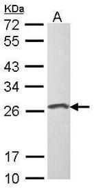 LOR Antibody in Western Blot (WB)
