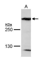 MAP1B Antibody in Western Blot (WB)