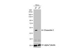 Presenilin 1 Antibody in Western Blot (WB)