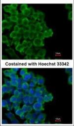 FABP4 Polyclonal Antibody
