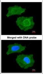 FABP4 Antibody in Immunocytochemistry (ICC/IF)