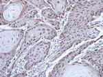FANCD2 Antibody in Immunohistochemistry (Paraffin) (IHC (P))
