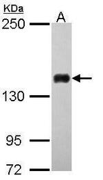 FANCD2 Antibody in Western Blot (WB)