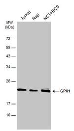 GPX1 Antibody in Western Blot (WB)