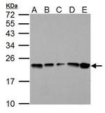 GPX1 Antibody in Western Blot (WB)