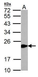 GPX1 Antibody in Western Blot (WB)
