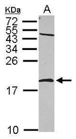 NME2 Antibody in Western Blot (WB)