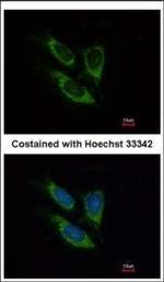 SOD2 Polyclonal Antibody