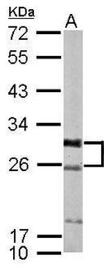 KCNIP1 Antibody in Western Blot (WB)