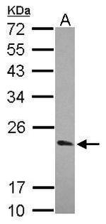 KCNIP1 Antibody in Western Blot (WB)