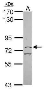 CGBP Polyclonal Antibody