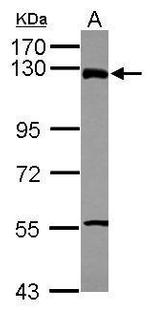 ZNF295 Polyclonal Antibody