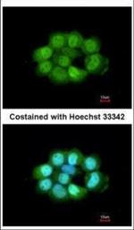 NOSIP Polyclonal Antibody