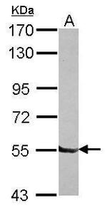 DBR1 Polyclonal Antibody