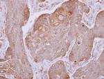 Dynactin 4 Polyclonal Antibody