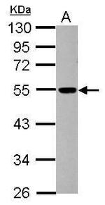 Dynactin 4 Antibody in Western Blot (WB)