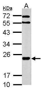 MARCH2 Polyclonal Antibody