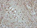 KLF3 Polyclonal Antibody