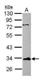 ETV7 Polyclonal Antibody