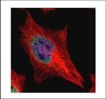 EAP2 Polyclonal Antibody