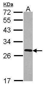 FKBP7 Antibody in Western Blot (WB)