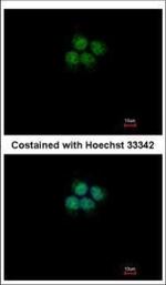 CPSF3 Polyclonal Antibody