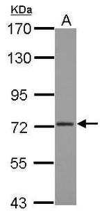 CPSF3 Polyclonal Antibody