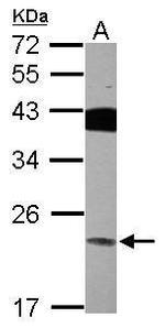 VPS29 Antibody in Western Blot (WB)
