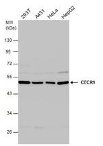 CECR1 Antibody in Western Blot (WB)