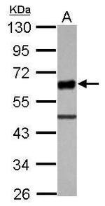 UBASH3A Polyclonal Antibody
