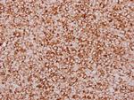 ZFYVE1 Antibody in Immunohistochemistry (Paraffin) (IHC (P))