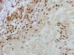 BRF2 Antibody in Immunohistochemistry (Paraffin) (IHC (P))